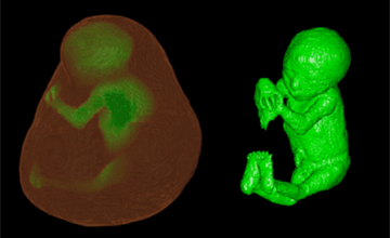 妊娠女性の腹部のMRI画像から作成した胎児モデル